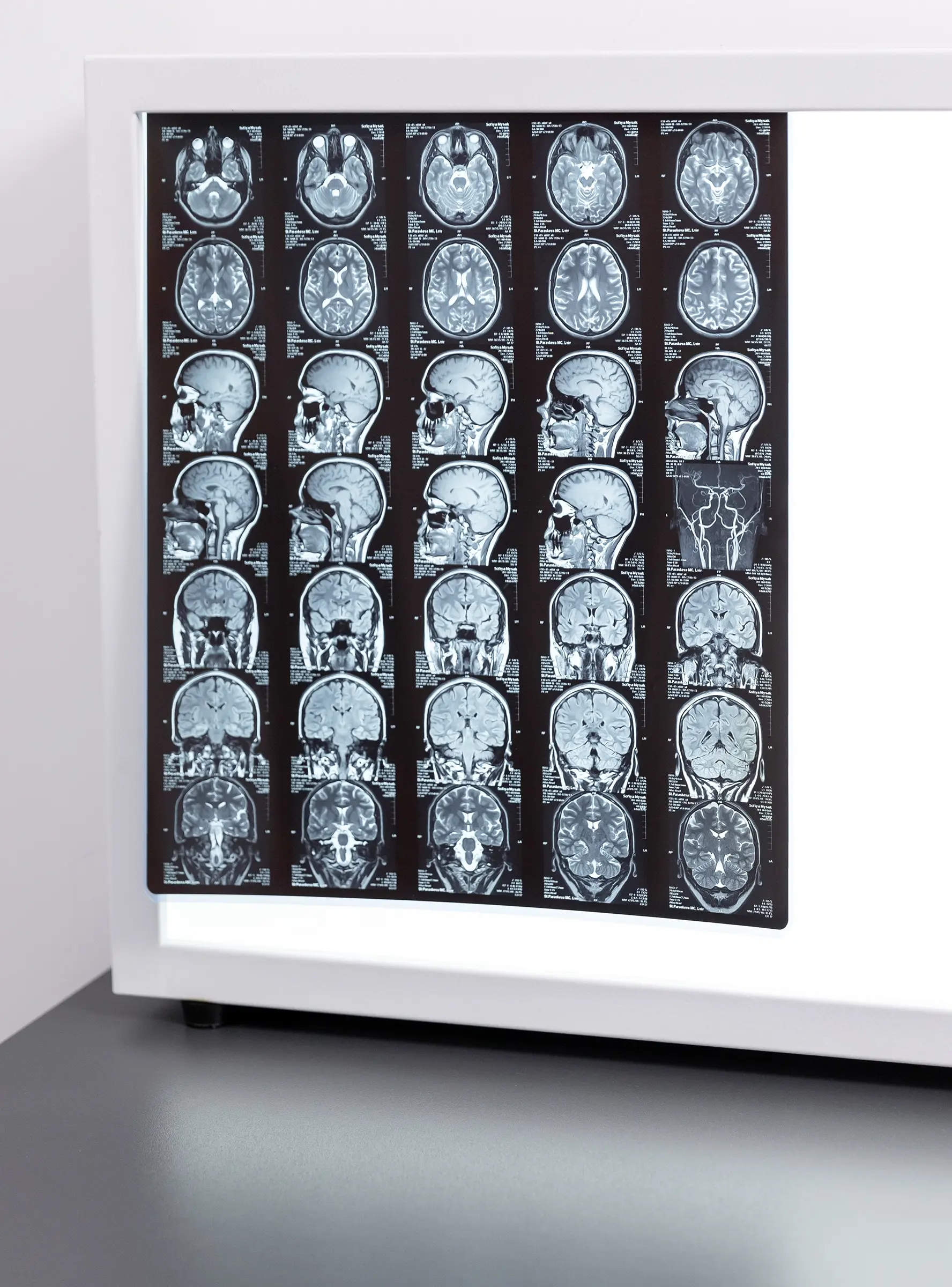 Невролог (невропатолог) у Львові