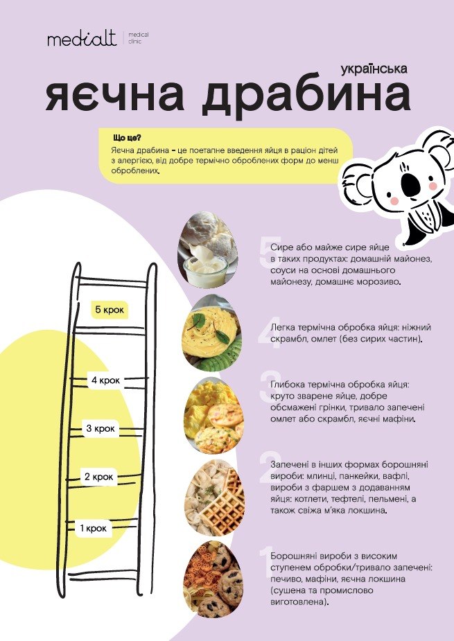 українська яєчна драбина