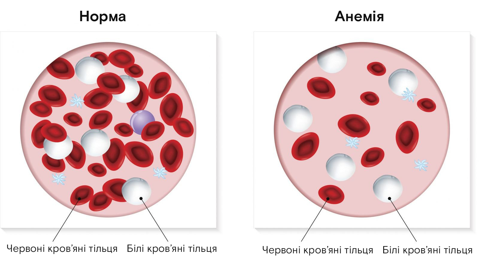 червоні тільця при нормі і при анемії